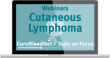 The 5th webinar of the EuroBloodNet's Topic on Focus: Cutaneous Lymphoma program already available on EuroBloodNet's EDU YouTube channel!